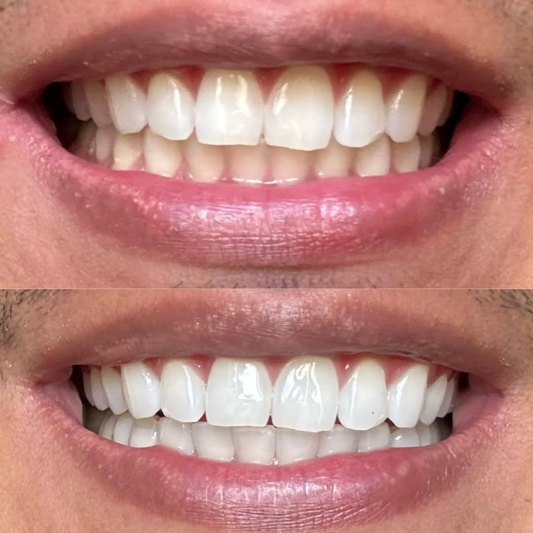 Antes e depois — caso 3